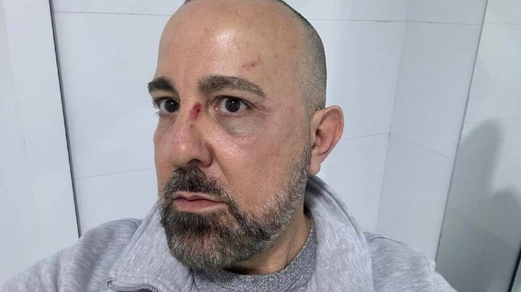 médicos cubanos fueron agredidos por agentes del régimen castrista en concierto en Madrid, España