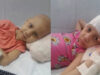 Piden ayuda a través de las redes sociales para una niña cubana con leucemia