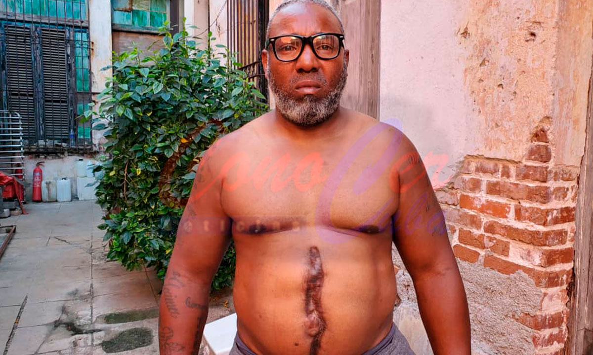 Puerto Terry baleado por el régimen de Cuba habla en Ginebra