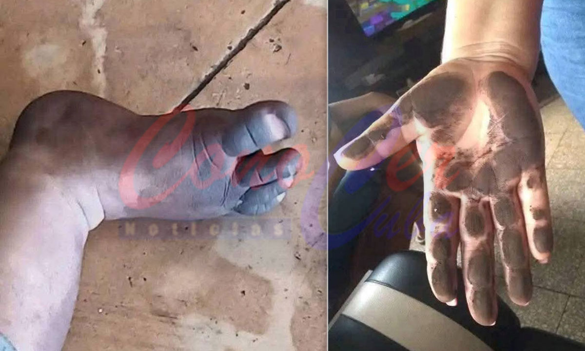 contaminación en Moa Holguín