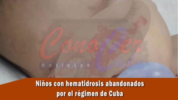 activista cubano denuncia abandono del régimen a dos niños con rara condición